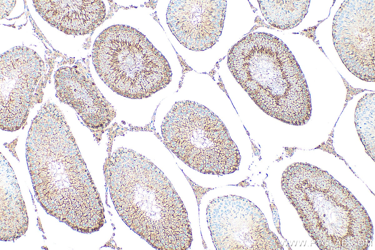 Immunohistochemistry (IHC) staining of rat testis tissue using COMMD4 Polyclonal antibody (31333-1-AP)