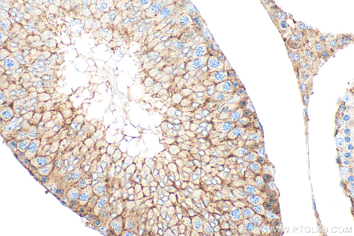 Immunohistochemistry (IHC) staining of rat testis tissue using COMMD4 Polyclonal antibody (31333-1-AP)