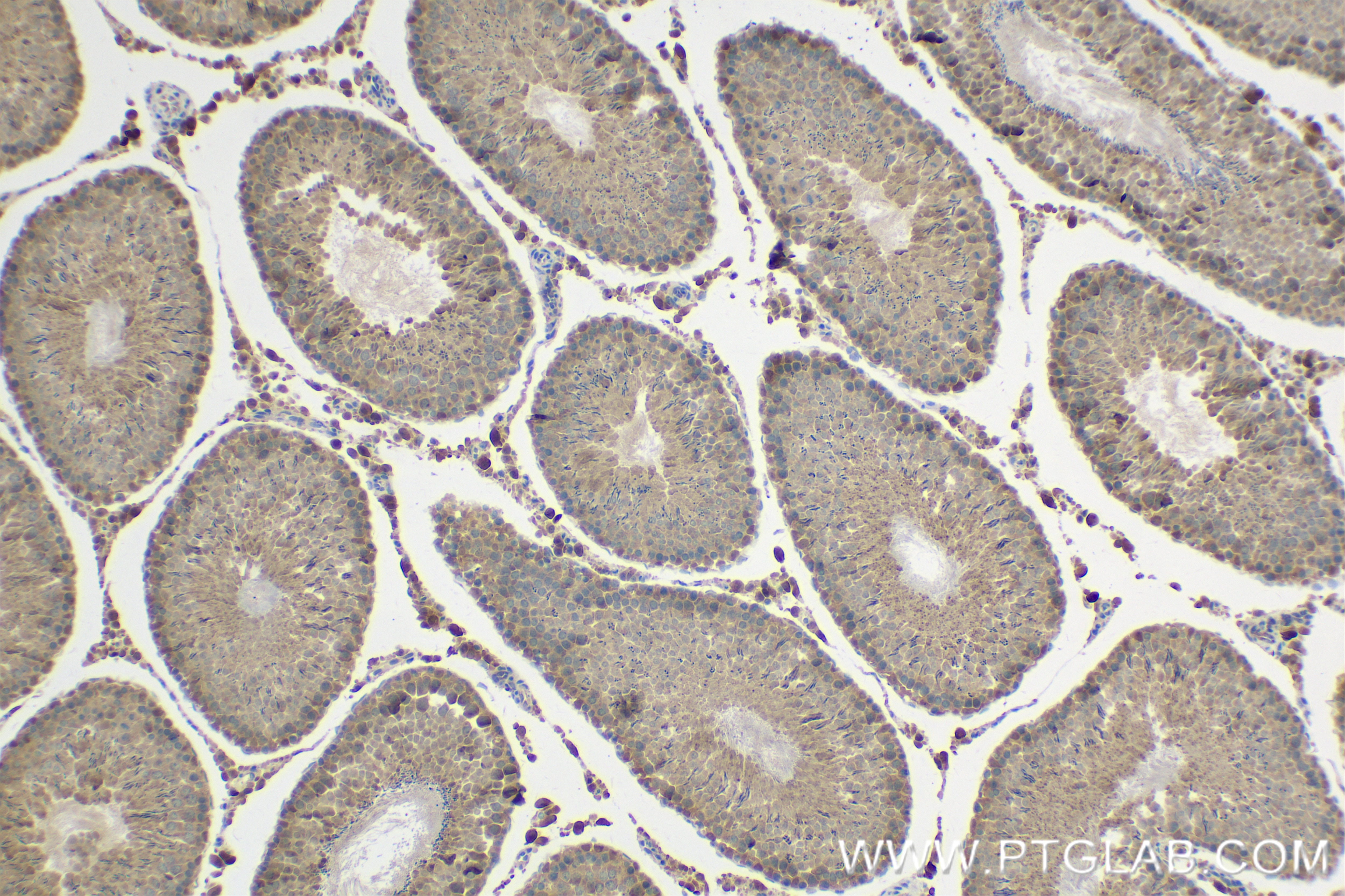 Immunohistochemistry (IHC) staining of rat testis tissue using COMMD4 Recombinant antibody (84664-4-RR)