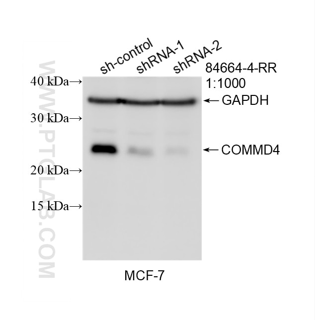 Western Blot (WB) analysis of MCF-7 cells using COMMD4 Recombinant monoclonal antibody (84664-4-RR)