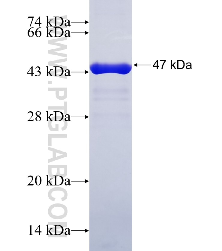 COMMD4 fusion protein Ag34904 SDS-PAGE