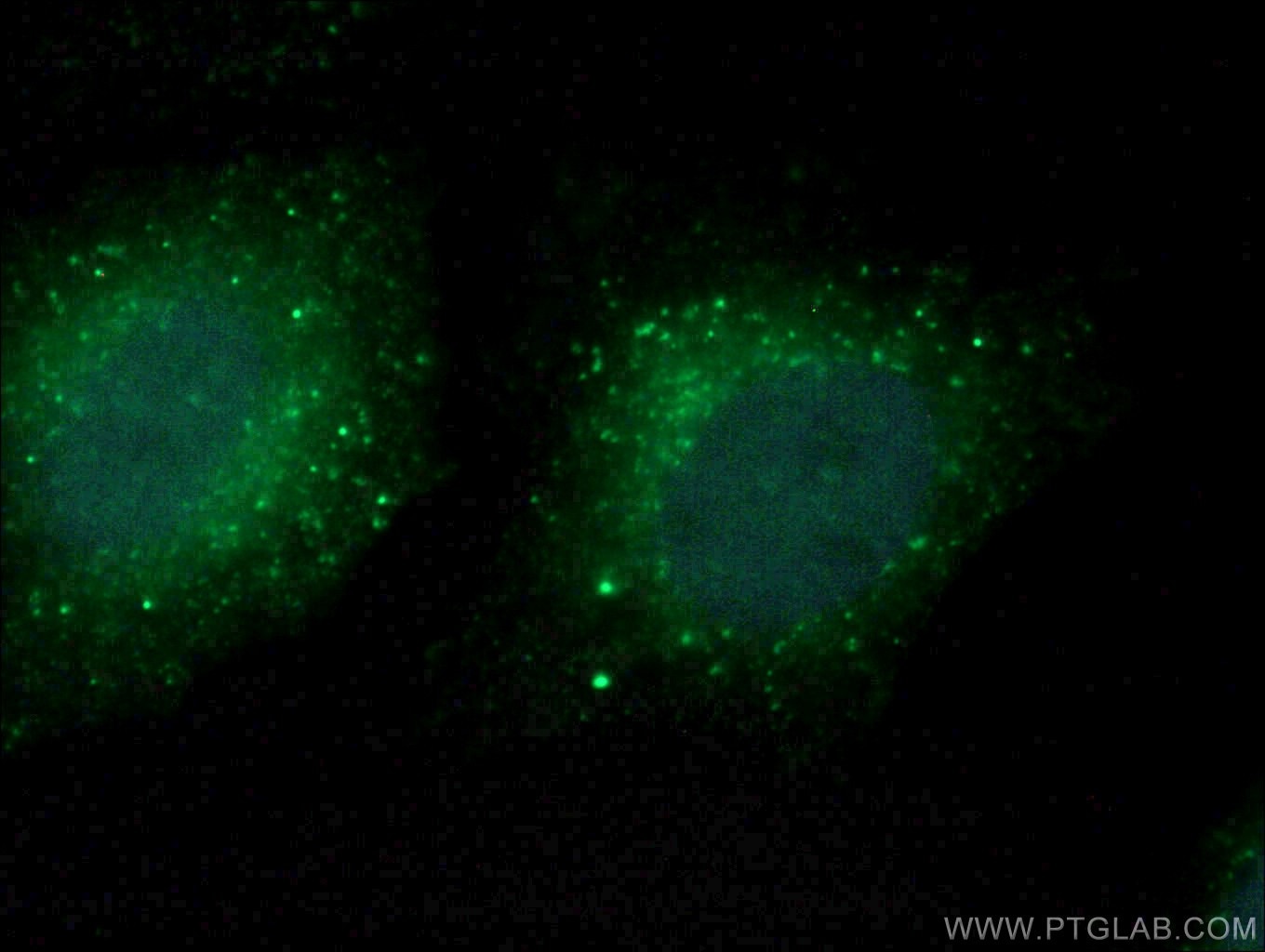 Immunofluorescence (IF) / fluorescent staining of HeLa cells using COMMD5 Polyclonal antibody (10393-1-AP)