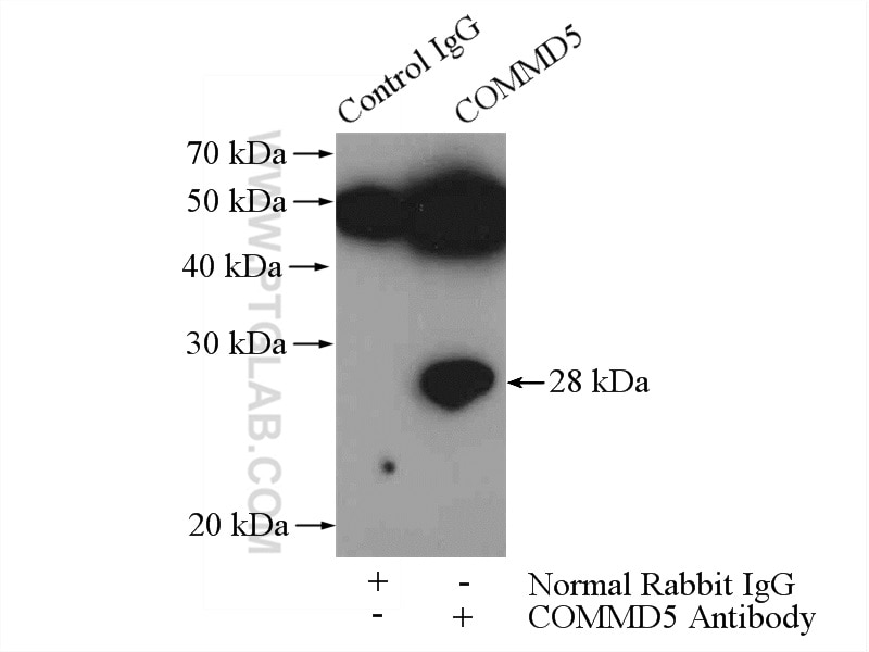 Immunoprecipitation (IP) experiment of mouse heart tissue using COMMD5 Polyclonal antibody (10393-1-AP)