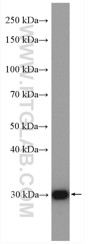Western Blot (WB) analysis of mouse kidney tissue using COMMD5 Polyclonal antibody (10393-1-AP)