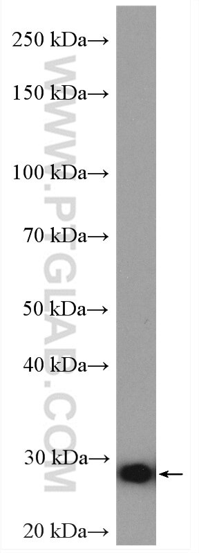 Western Blot (WB) analysis of human placenta tissue using COMMD5 Polyclonal antibody (10393-1-AP)