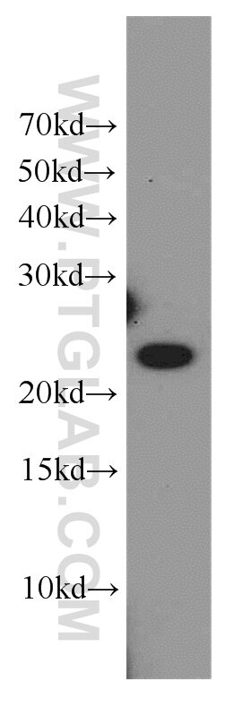 Western Blot (WB) analysis of human stomach tissue using COMMD5 Polyclonal antibody (10393-1-AP)