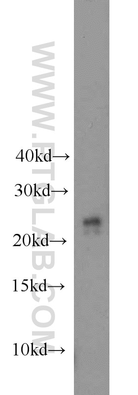 Western Blot (WB) analysis of mouse stomach tissue using COMMD5 Polyclonal antibody (10393-1-AP)