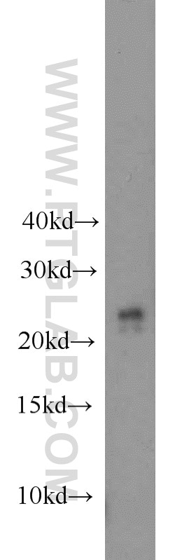 WB analysis of mouse stomach using 10393-1-AP