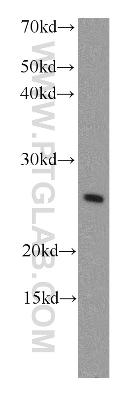 Western Blot (WB) analysis of mouse heart tissue using COMMD5 Polyclonal antibody (10393-1-AP)
