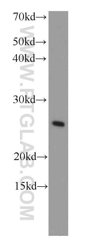 Western Blot (WB) analysis of mouse heart tissue using COMMD5 Polyclonal antibody (10393-1-AP)