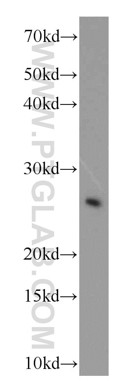 Western Blot (WB) analysis of HEK-293 cells using COMMD5 Polyclonal antibody (10393-1-AP)