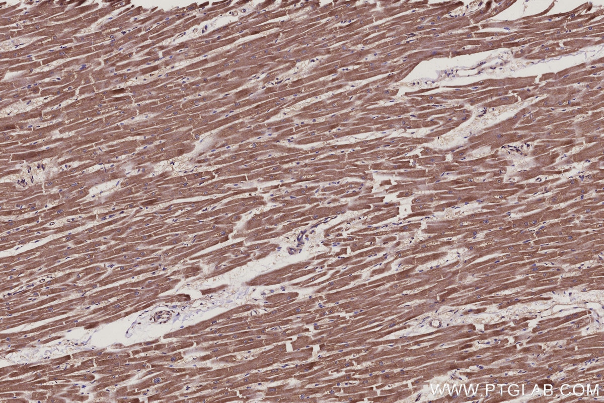Immunohistochemistry (IHC) staining of human heart tissue using COMMD5 Monoclonal antibody (67043-1-Ig)