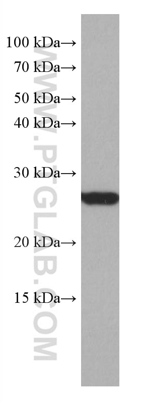 Western Blot (WB) analysis of HEK-293 cells using COMMD5 Monoclonal antibody (67043-1-Ig)
