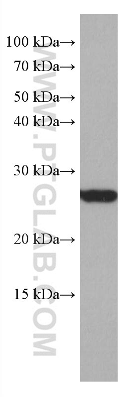 Western Blot (WB) analysis of HEK-293 cells using COMMD5 Monoclonal antibody (67043-1-Ig)