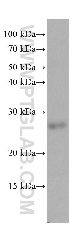 Western Blot (WB) analysis of rat heart tissue using COMMD5 Monoclonal antibody (67043-1-Ig)