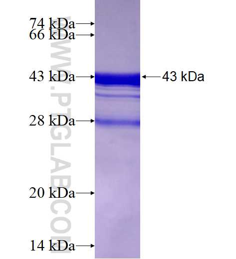 COMMD5 fusion protein Ag0592 SDS-PAGE