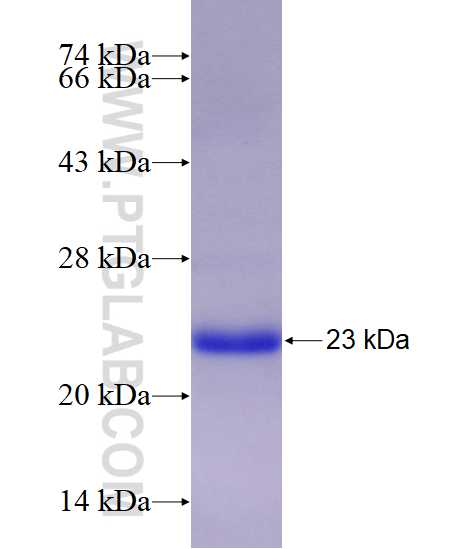 COMMD5 fusion protein Ag18464 SDS-PAGE
