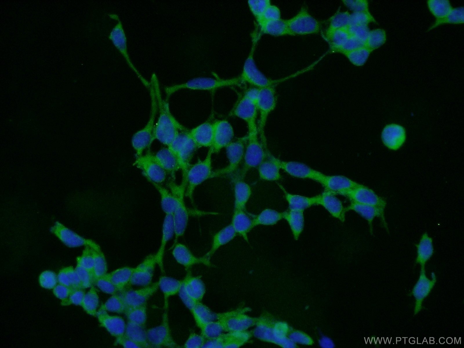 Immunofluorescence (IF) / fluorescent staining of HEK-293 cells using COMMD8 Polyclonal antibody (25237-1-AP)