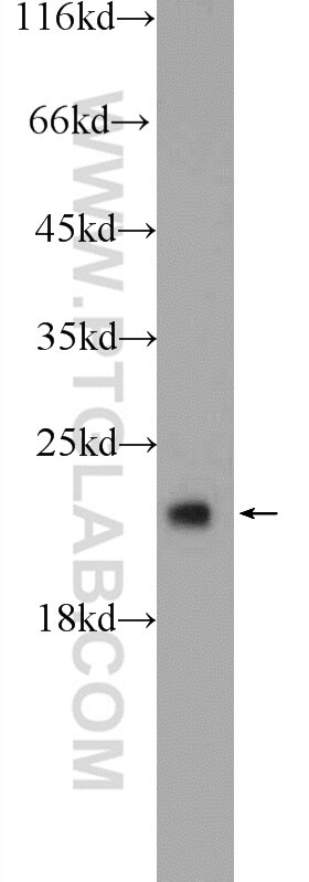 Western Blot (WB) analysis of HEK-293 cells using COMMD8 Polyclonal antibody (25237-1-AP)