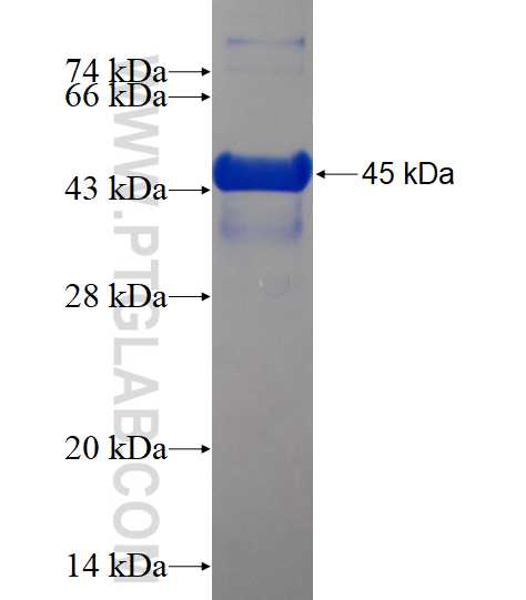 COMMD8 fusion protein Ag18712 SDS-PAGE