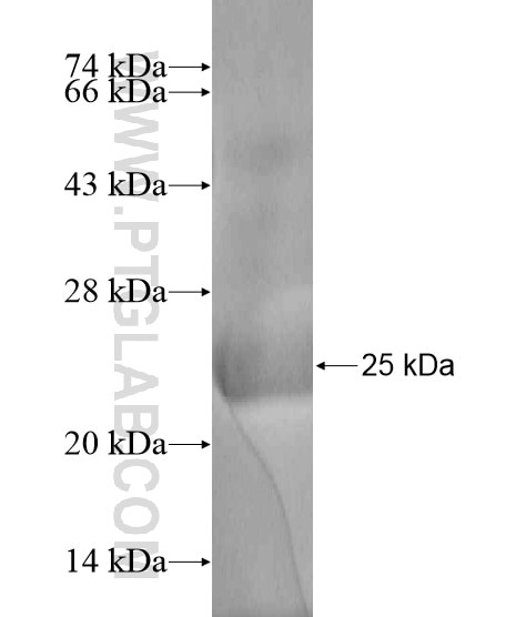 COMMD8 fusion protein Ag18973 SDS-PAGE
