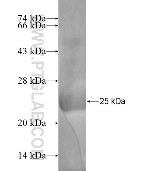 COMMD8 fusion protein Ag18973 SDS-PAGE