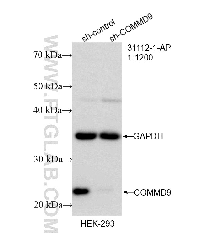 WB result of COMMD9 antibody (31112-1-AP; 1:1200; incubated at room temperature for 1.5 hours) with sh-Control and sh-COMMD9 transfected HEK-293 cells. Western Blot (WB) analysis of HEK-293 cells using COMMD9 Polyclonal antibody (31112-1-AP)