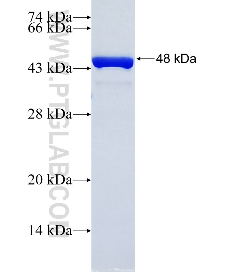 COMMD9 fusion protein Ag35078 SDS-PAGE