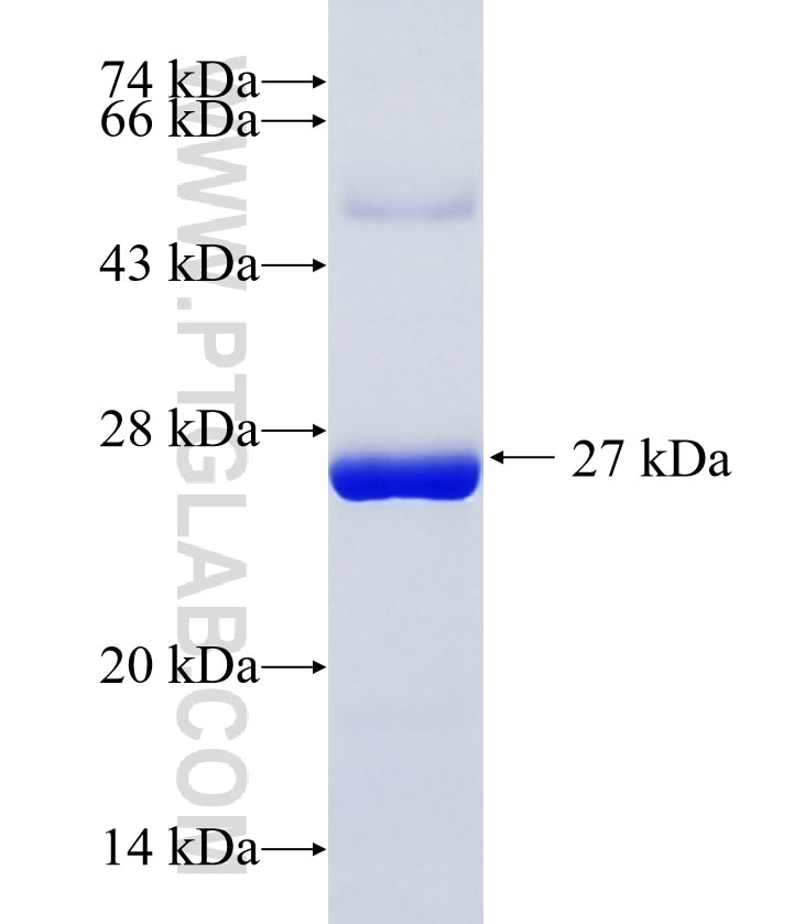 COMMD9 fusion protein Ag35344 SDS-PAGE COMMD9 fusion protein Ag35344 SDS-PAGE