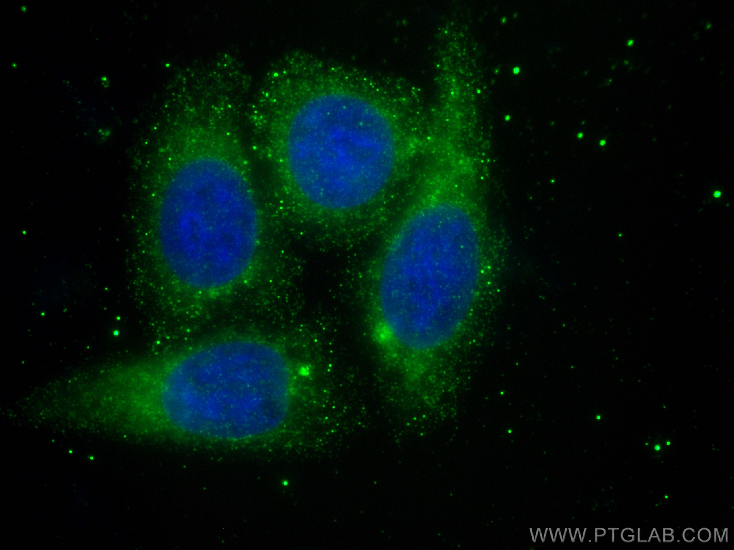 Immunofluorescence (IF) / fluorescent staining of HepG2 cells using COMP Polyclonal antibody (28369-1-AP)