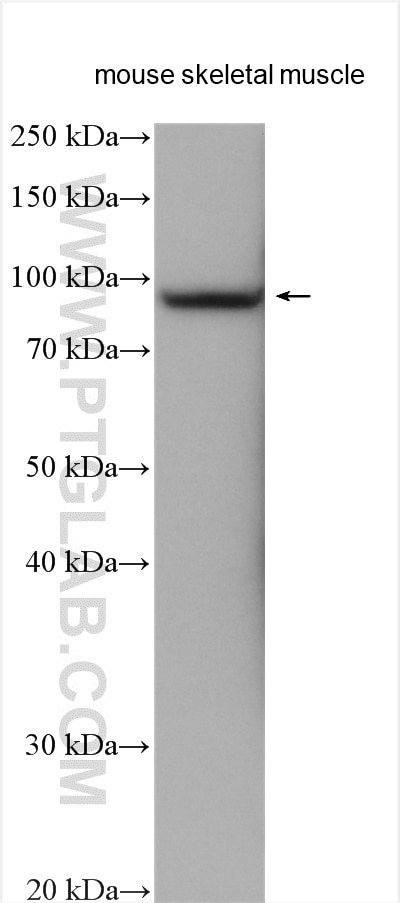 Western Blot (WB) analysis of various lysates using COMP Polyclonal antibody (28369-1-AP)