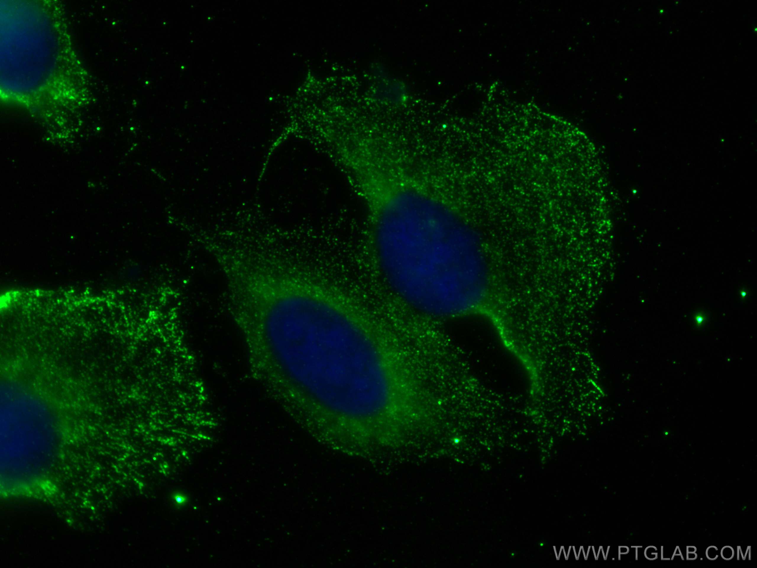 Immunofluorescence (IF) / fluorescent staining of U2OS cells using COMP Monoclonal antibody (66793-1-Ig)