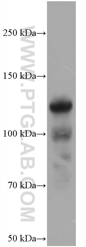 Western Blot (WB) analysis of pig cartilage tissue using COMP Monoclonal antibody (66793-1-Ig)