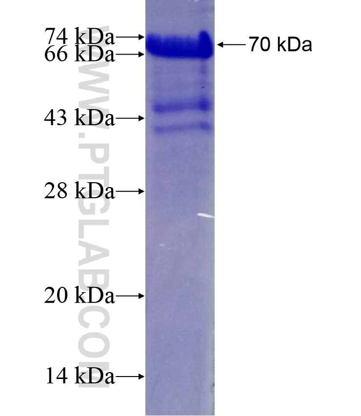 COMP fusion protein Ag4575 SDS-PAGE