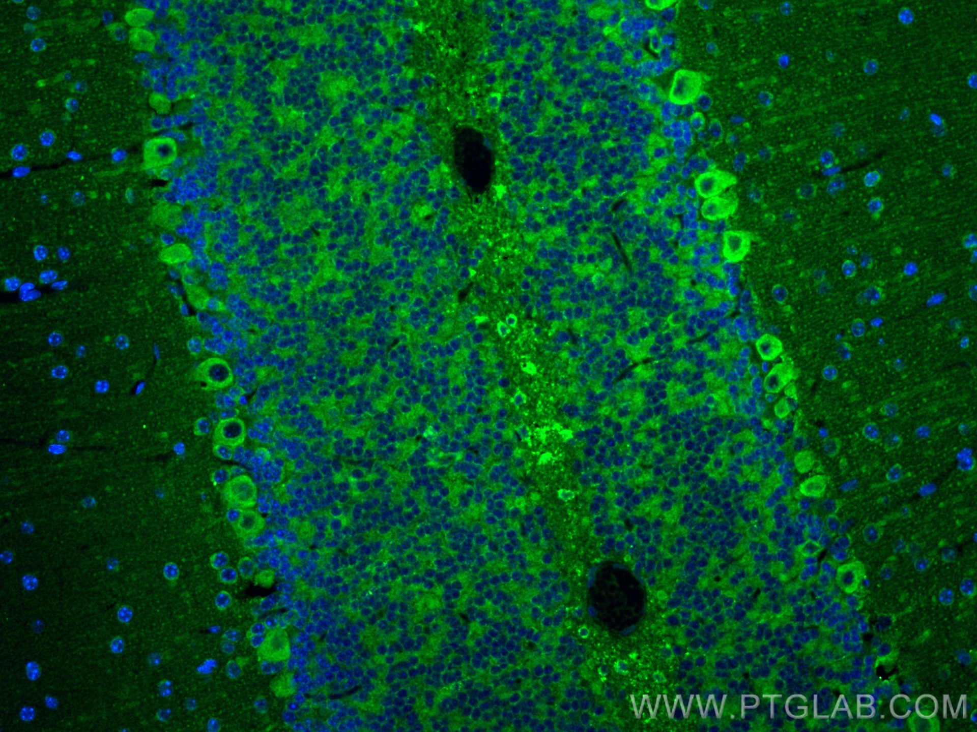 Immunofluorescence (IF) / fluorescent staining of mouse cerebellum tissue using COMT Polyclonal antibody (14754-1-AP)