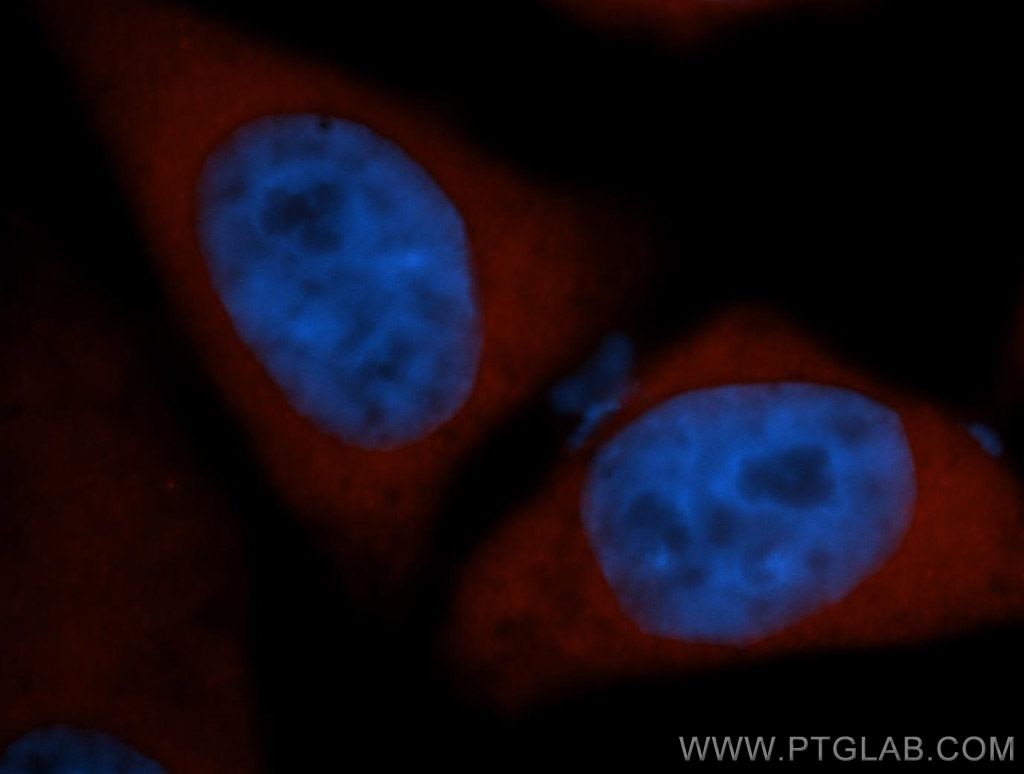 Immunofluorescence (IF) / fluorescent staining of HepG2 cells using COMT Polyclonal antibody (14754-1-AP)