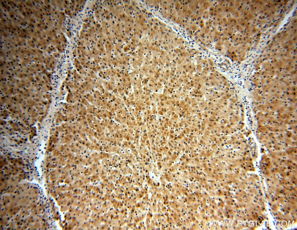 Immunohistochemistry (IHC) staining of human liver tissue using COMT Polyclonal antibody (14754-1-AP)