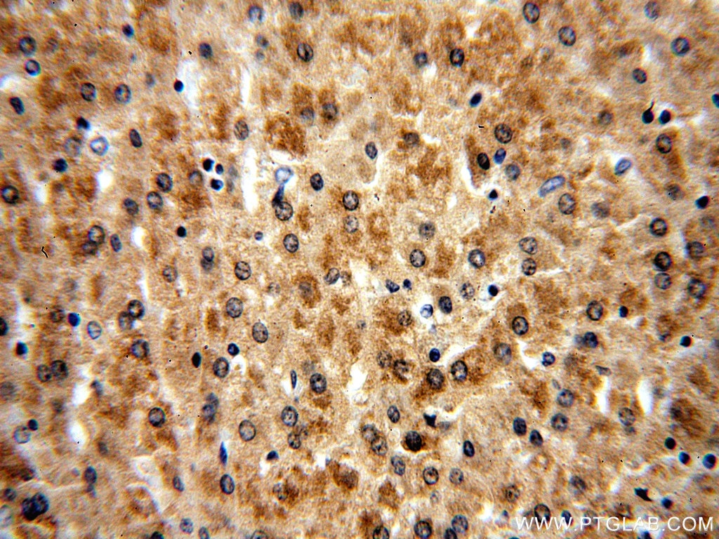 Immunohistochemistry (IHC) staining of human liver tissue using COMT Polyclonal antibody (14754-1-AP)