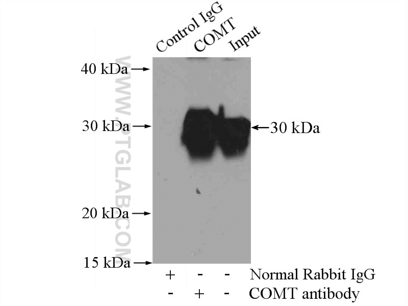 Immunoprecipitation (IP) experiment of K-562 cells using COMT Polyclonal antibody (14754-1-AP)