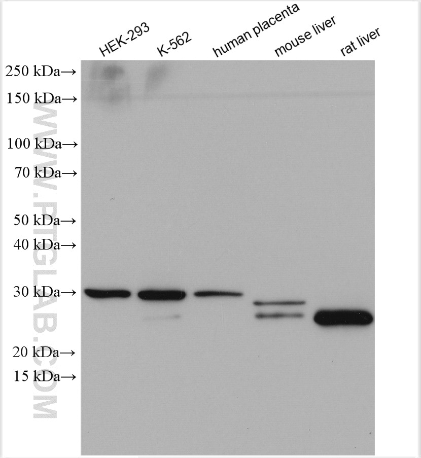 Western Blot (WB) analysis of various lysates using COMT Polyclonal antibody (14754-1-AP)