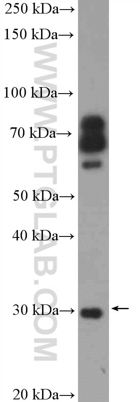 COMT Polyclonal antibody