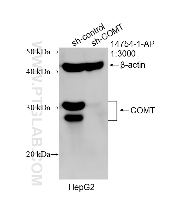 Western Blot (WB) analysis of HepG2 cells using COMT Polyclonal antibody (14754-1-AP)
