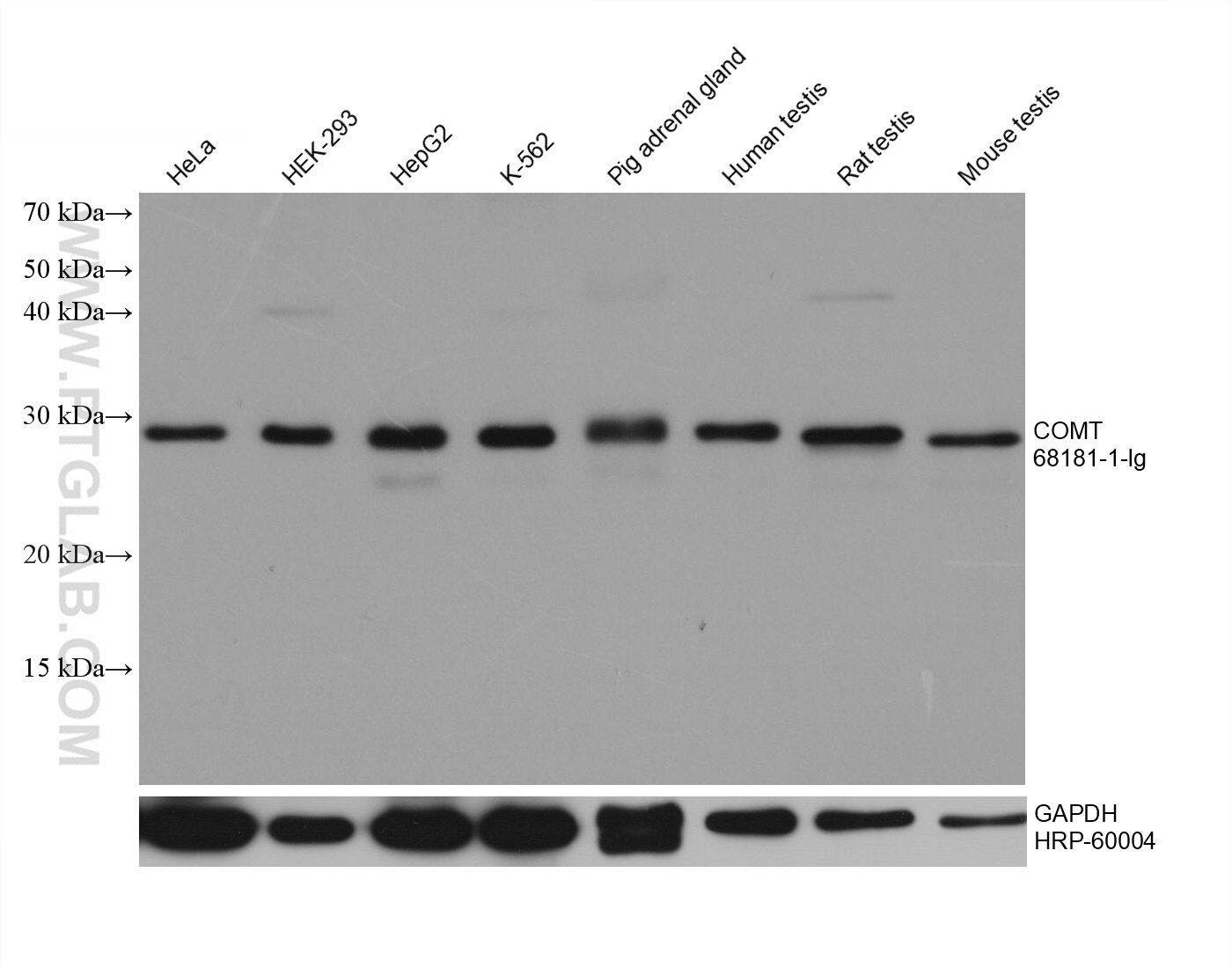 Western Blot (WB) analysis of various lysates using COMT Monoclonal antibody (68181-1-Ig)