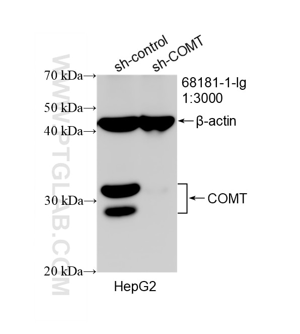 Western Blot (WB) analysis of HepG2 cells using COMT Monoclonal antibody (68181-1-Ig)