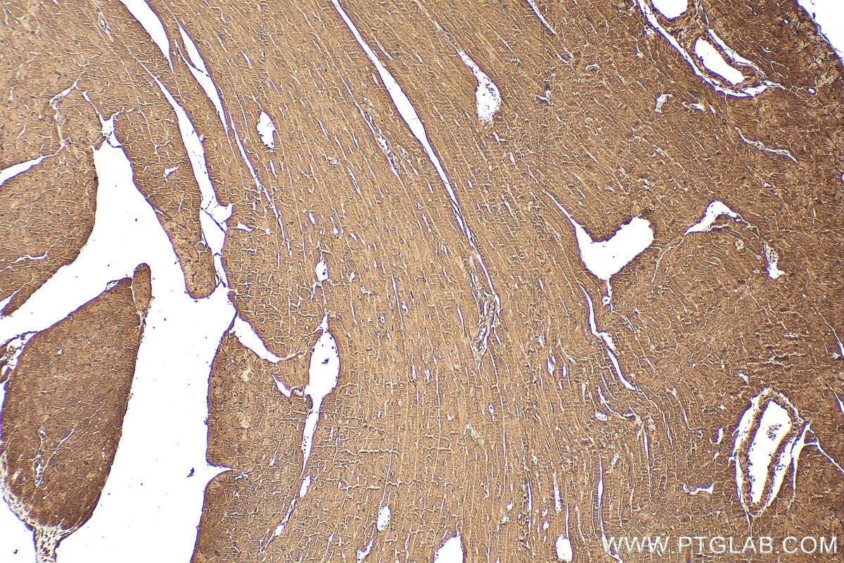 Immunohistochemistry (IHC) staining of mouse heart tissue using COP1 Polyclonal antibody (28395-1-AP)