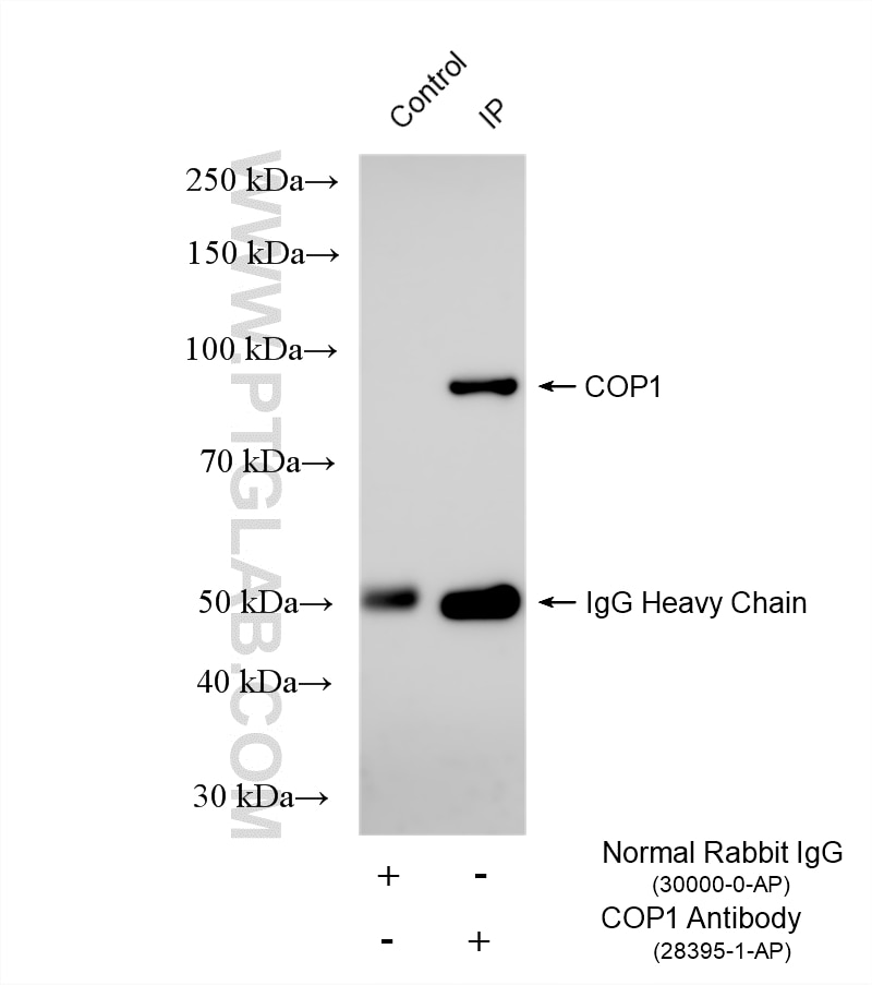 Immunoprecipitation (IP) experiment of HCT 116 cells using COP1 Polyclonal antibody (28395-1-AP)