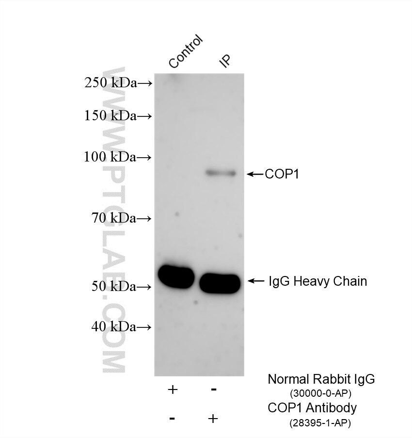 Immunoprecipitation (IP) experiment of HeLa cells using COP1 Polyclonal antibody (28395-1-AP)