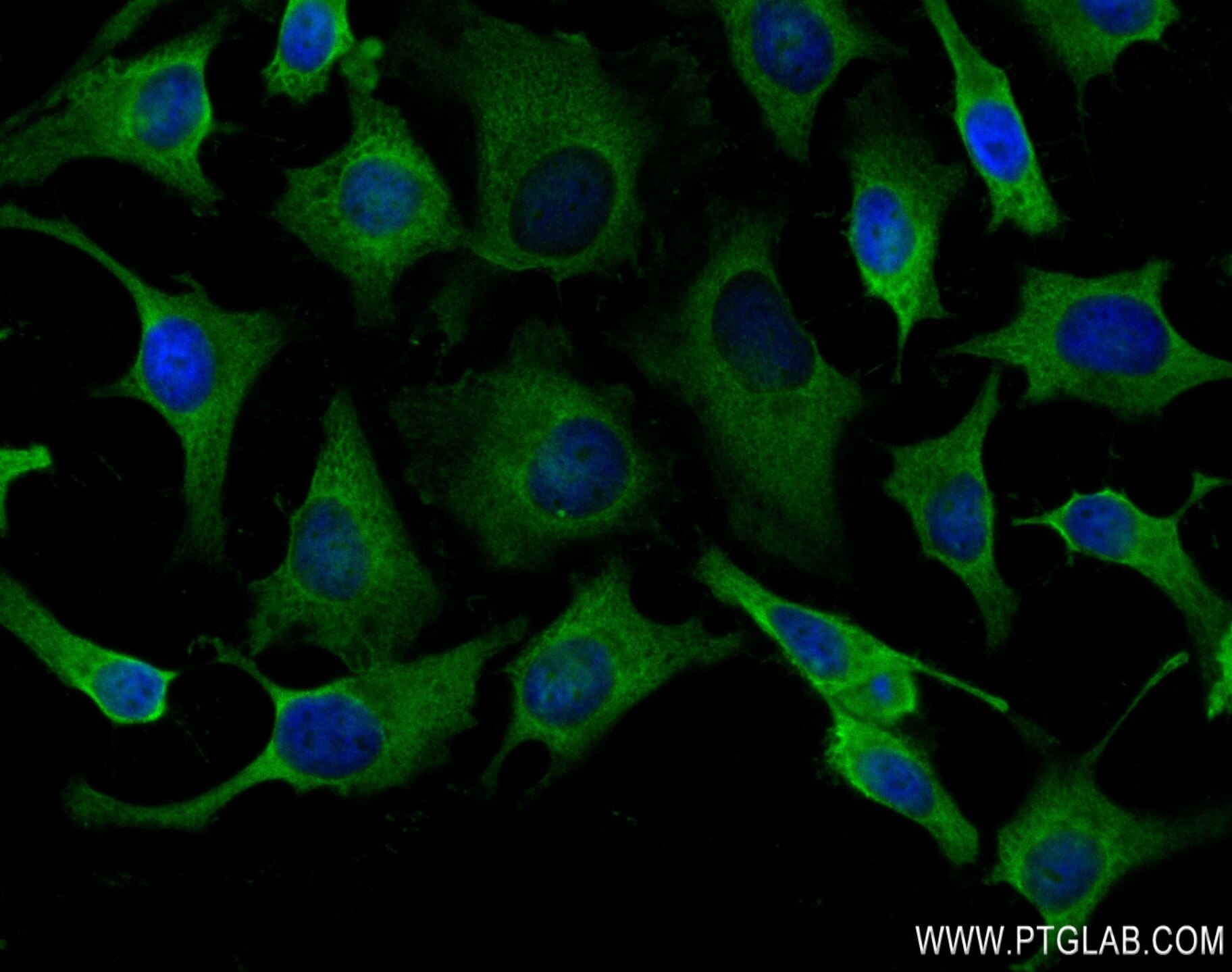 Immunofluorescence (IF) / fluorescent staining of HeLa cells using COPA Recombinant antibody (83089-2-RR)