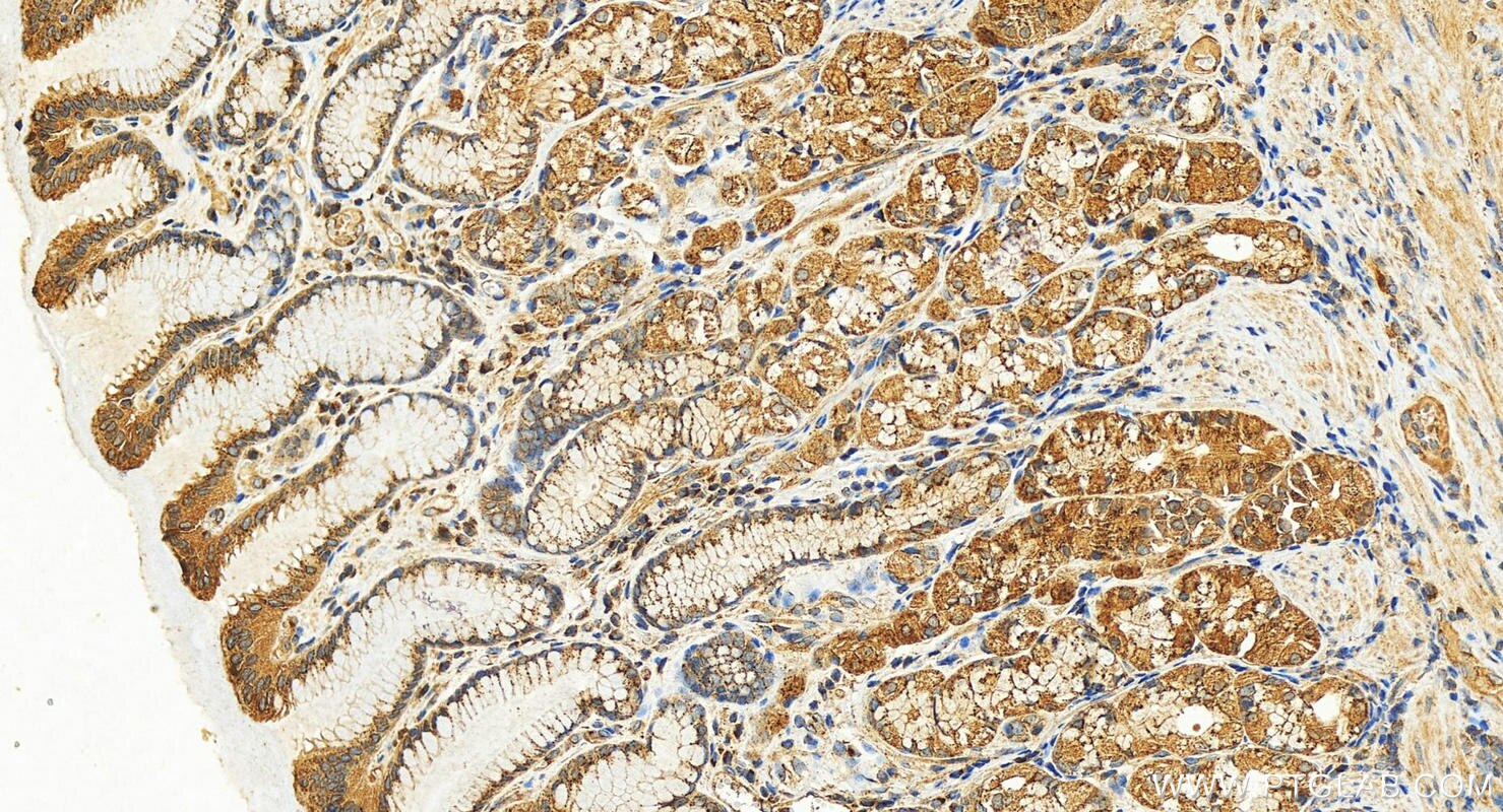 Immunohistochemistry (IHC) staining of human stomach tissue using COPB1 Polyclonal antibody (27469-1-AP)