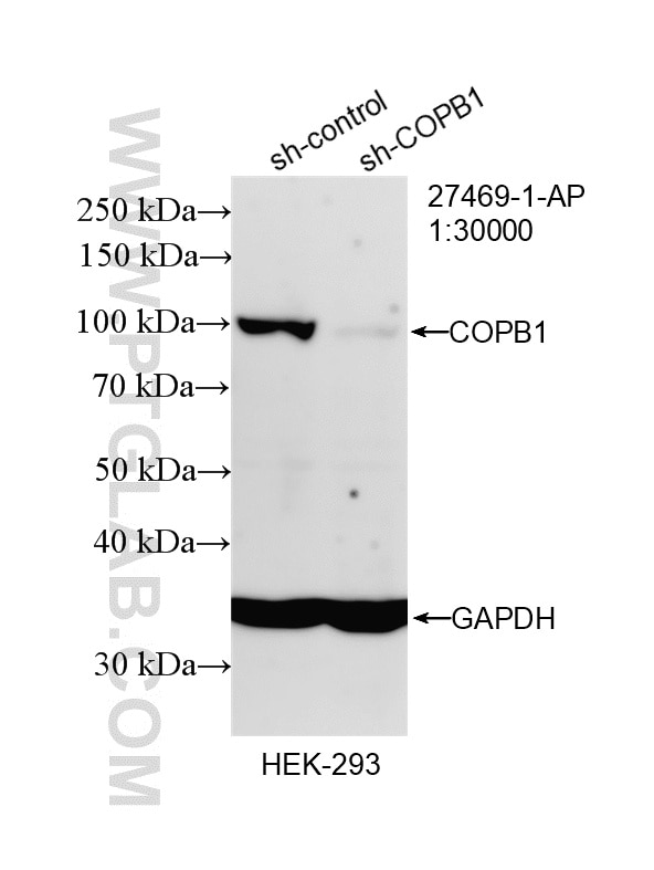 Western Blot (WB) analysis of HEK-293 cells using COPB1 Polyclonal antibody (27469-1-AP)